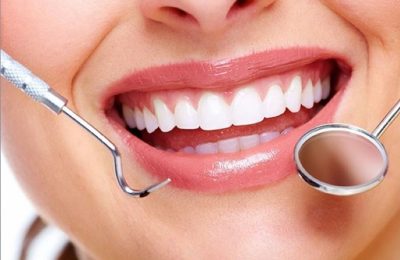 VIP Smile